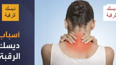 ديسك الرقبة