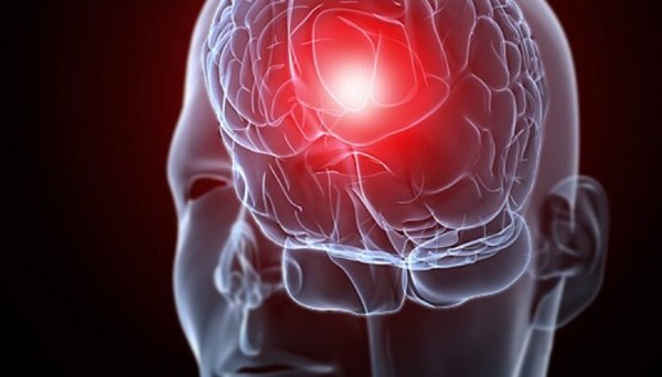 أسباب الصداع في مقدمة الرأس وأنواعه