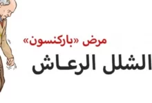 علاج شلل الرعاش (باركنسون) والوقاية منه 25 علاج شلل الرعاش (باركنسون) والوقاية منه