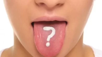 مرارة الفم