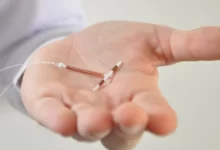 أضرار اللولب الرحمي IUD IMPLANTATION
