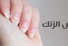 أعراض نقص الزنك وفوائده للجسم