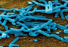 فيروس ماربورغ الفتاك تعرف على الأعراض وطرق الوقاية 24 فيروس ماربورغ