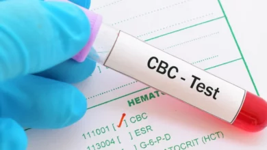تحليل الدم الشامل 10 نصائح هامة قبل إجرائه