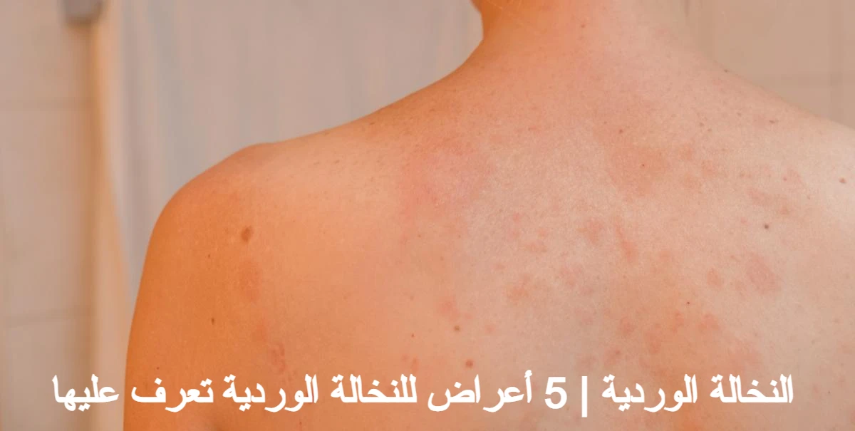 النخالة الوردية