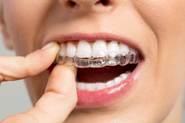 اوسبيلدونغ أخصائي تقويم الأسنان في ألمانيا 3 اوسبيلدونغ أخصائي تقويم الأسنان