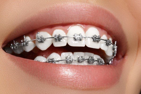 اوسبيلدونغ أخصائي تقويم الأسنان في ألمانيا 2 اوسبيلدونغ أخصائي تقويم الأسنان
