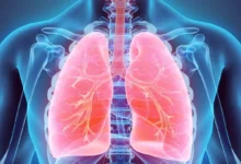 مرض إنتفاخ الرئة وأعراضه وأسبابه و 4 طرق للوقاية 27 مرض إنتفاخ الرئة