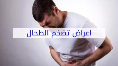 تضخم الطحال