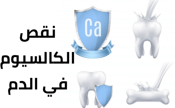 نقص كالسيوم الدم