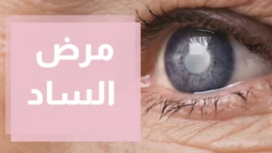 مرض الساد
