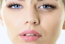 كيفية التخلص من تجاعيد الوجه في وقت قصير