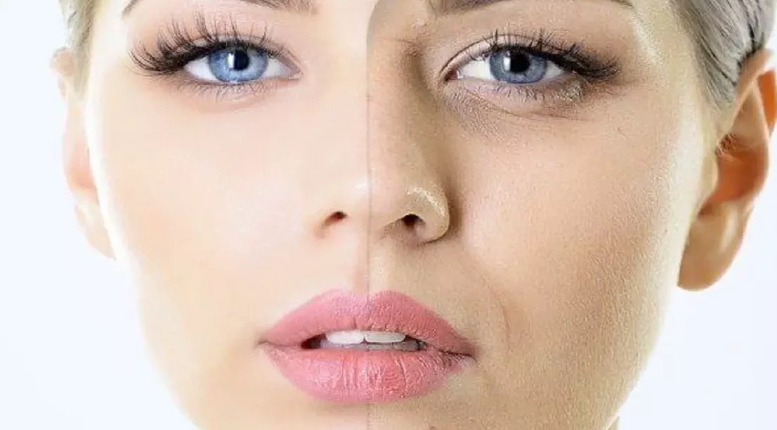 كيفية التخلص من تجاعيد الوجه في وقت قصير