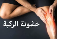 أسماء أدوية خشونة الركبة 