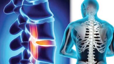 متى يسمح بالجماع بعد عملية الغضروف ؟ 20 متى يسمح بالجماع بعد عملية الغضروف