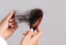 اسباب تساقط الشعر