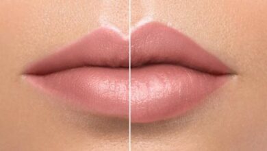 حكم عمليات التجميل