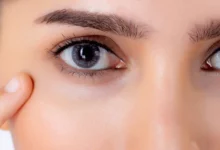 ماسك الهالات السوداء