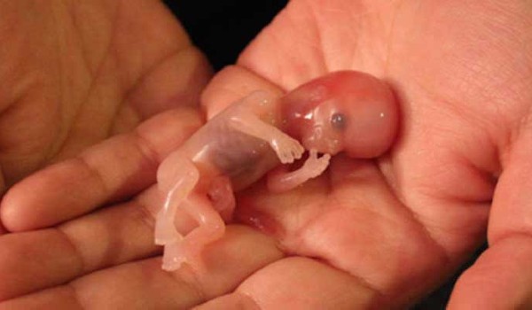 حكم اجهاض الجنين قبل نفخ الروح في الاسلام 2 حكم اجهاض الجنين