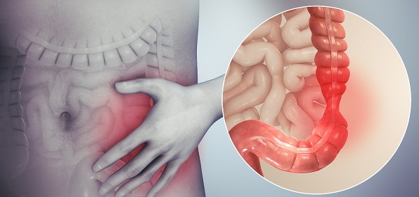 أعراض الخلعة في المعدة والقولون3